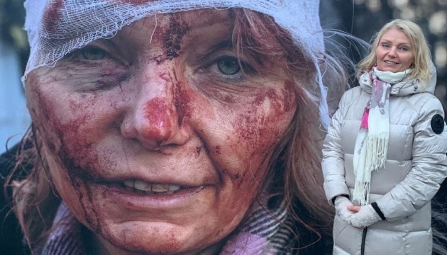 630_360_1771932308-266